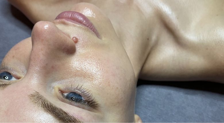 Environ’s Lactic Acid Hydration Facial